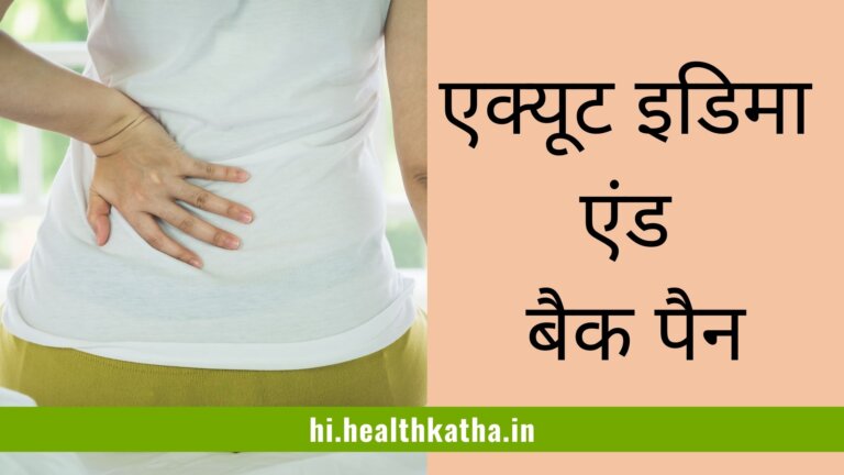 Acute Edema and Back Pain (एक्यूट इडिमा एंड बैक पैन) in Hindi